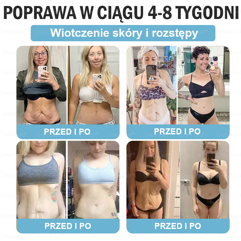 🔥CrazyLeaf® GLP-1 6 az 1-ben Fit & Vital Szájon át szedhető oldat – Napi egyszer, 7 nap alatt látható változás / Elhízás, szív- és érrendszeri egészség, cukorbetegség, alvási apnoe, bélrendszer egészsége, ízületi problémák és még sok más esetén