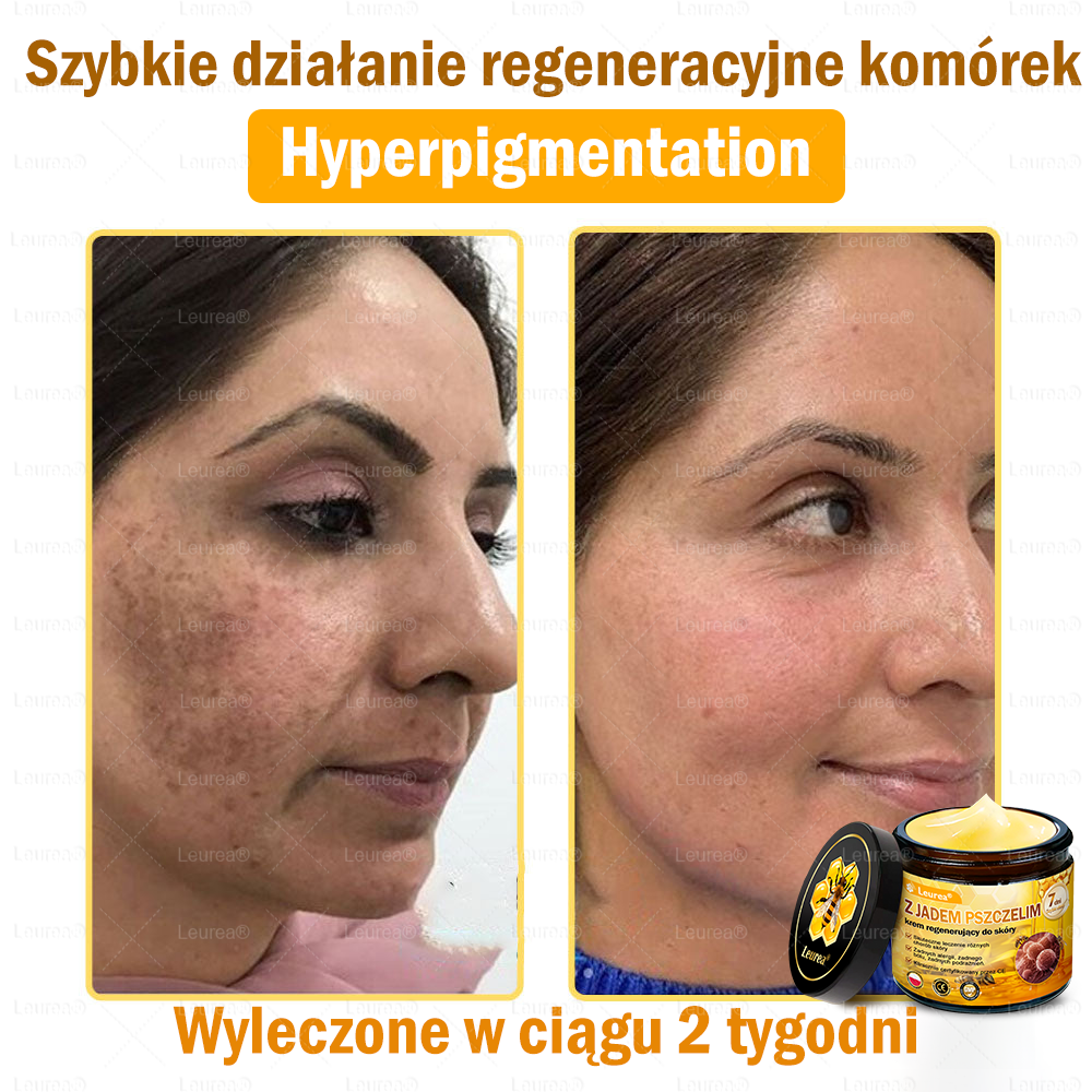 ✨✨Leurea® Krem Regenerujący z Jadem Pszczelim🔥 Naturalna regeneracja skóry, wygładzenie zmarszczek i promienna cera-50 ml