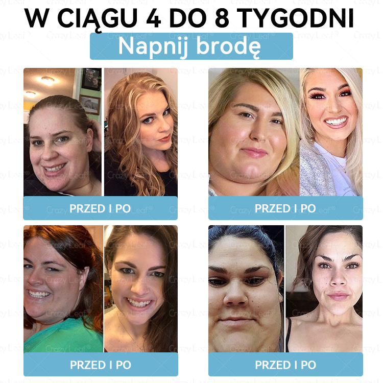 🔥CrazyLeaf® GLP-1 6 az 1-ben Fit & Vital Szájon át szedhető oldat – Napi egyszer, 7 nap alatt látható változás / Elhízás, szív- és érrendszeri egészség, cukorbetegség, alvási apnoe, bélrendszer egészsége, ízületi problémák és még sok más esetén