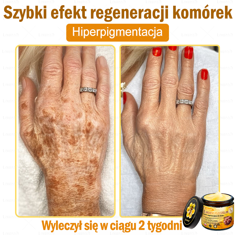✨✨Leurea® Krem Regenerujący z Jadem Pszczelim🔥 Naturalna regeneracja skóry, wygładzenie zmarszczek i promienna cera-50 ml