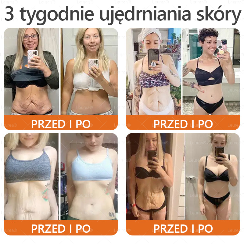 ✨✨Leurea® Krem Regenerujący z Jadem Pszczelim🔥 Naturalna regeneracja skóry, wygładzenie zmarszczek i promienna cera-50 ml