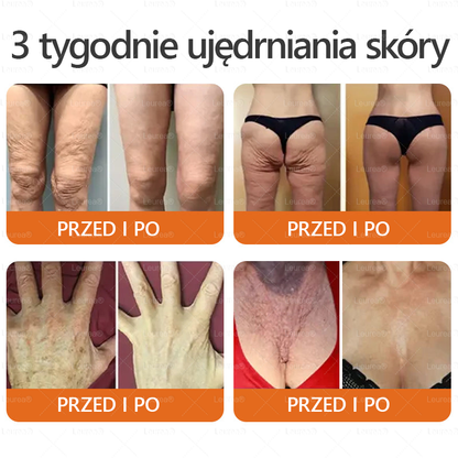 ✨✨Leurea® Krem Regenerujący z Jadem Pszczelim🔥 Naturalna regeneracja skóry, wygładzenie zmarszczek i promienna cera-50 ml