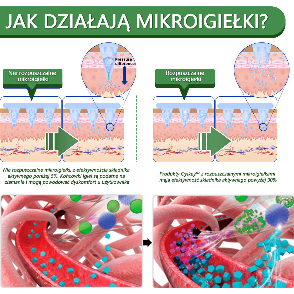 Voilaist® SMGT-GLP-1 Nano Microneedle Patch🍃Bezbolesny, długotrwały, zwalczający cukrzycę, otyłość i choroby układu krążenia