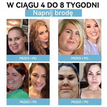 🔥CrazyLeaf® GLP-1 6 az 1-ben Fit & Vital Szájon át szedhető oldat – Napi egyszer, 7 nap alatt látható változás / Elhízás, szív- és érrendszeri egészség, cukorbetegség, alvási apnoe, bélrendszer egészsége, ízületi problémák és még sok más esetén
