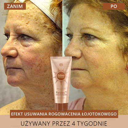 💟 Parowu™ Wybielająca i Rozjaśniająca Maska - Naturalne składniki trwale usuwają plamy, piegi i przebarwienia
