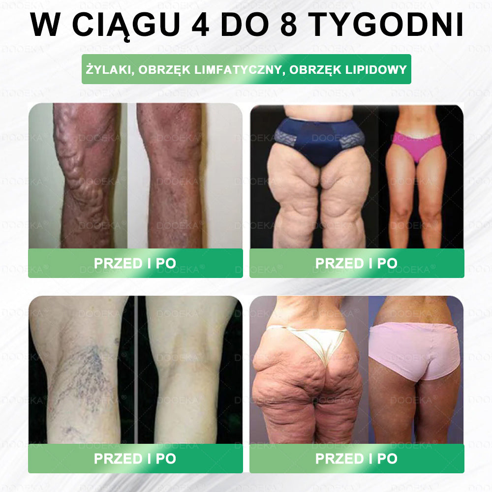 👨‍⚕‍DOOEKA® GLP-1 8 w 1 Fit & Vital roztwór doustny – Raz dziennie, widoczne zmiany w ciągu 7 dni / W przypadku otyłości, zdrowia serca i układu krążenia, cukrzycy, bezdechu sennego, zdrowia jelit, problemów ze stawami i wielu innych