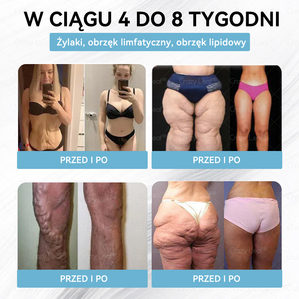 🔥CrazyLeaf® GLP-1 6 az 1-ben Fit & Vital Szájon át szedhető oldat – Napi egyszer, 7 nap alatt látható változás / Elhízás, szív- és érrendszeri egészség, cukorbetegség, alvási apnoe, bélrendszer egészsége, ízületi problémák és még sok más esetén
